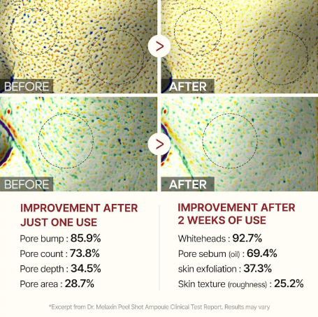 TLOPA® Glow Rice Ampoule Set - Skin Brightening Duo