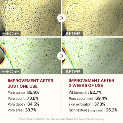 TLOPA® Glow Rice Ampoule Set - Skin Brightening Duo