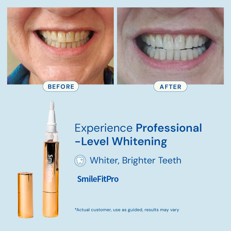SmileBright™ Teeth Whitening Pen